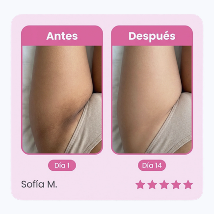 Antes y después — zonas intimas